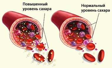 продукты с высоким гликемическим индексом