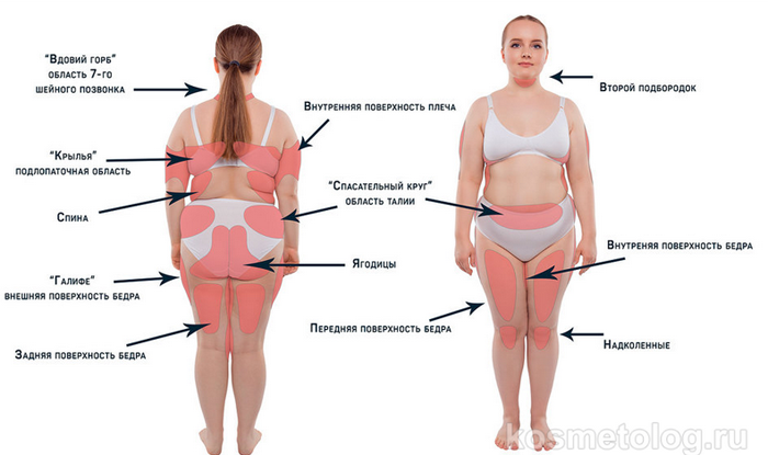 почему жир на теле скапливается в одном месте